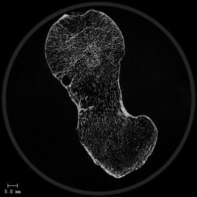 csm_UCT100_HUMAN_FEMUR_2D_1_ba397e2958